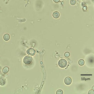 ホシノ天然酵母検鏡写真